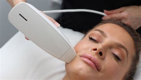Venus Viva Skin Resurfacing Redefines Ageless Beauty.